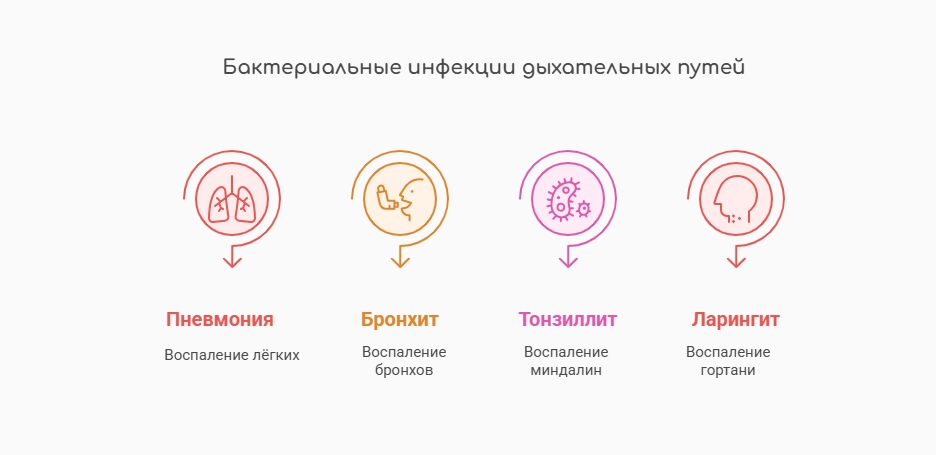 Бактериальные инфекции дыхательных путей (инфографика)